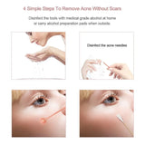 best blackhead remover kit | Shopsglam