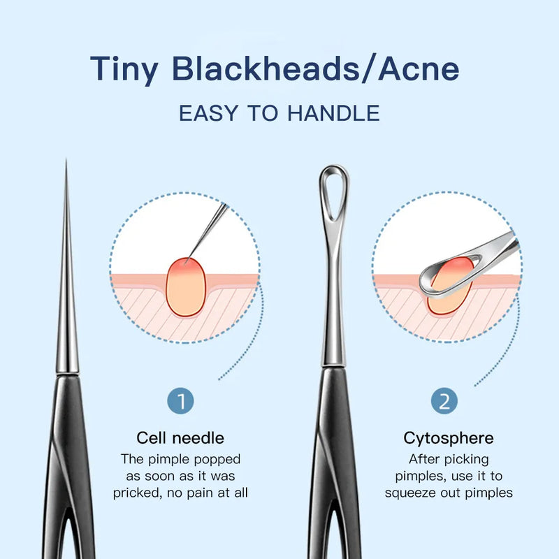 needle and loop blackhead remover  | Shopsglam